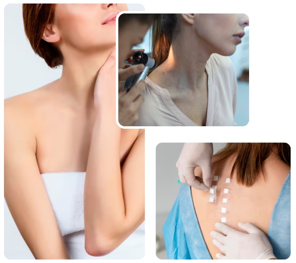 Dermatology Department