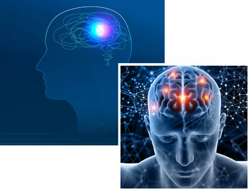 Neurology Department